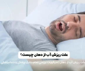 علت ریزش آب از دهان